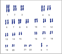 染色体イメージ