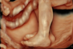 胎児ドックイメージ